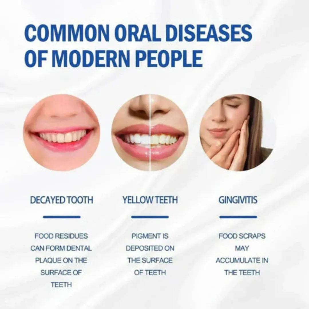 Sp-4 probiotic whitening toothpaste, Teeth Whitener Toothpaste, Natural Tooth Whitener (Buy 1 Get 1 Free)