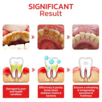 Sp-4 probiotic whitening toothpaste, Teeth Whitener Toothpaste, Natural Tooth Whitener (Buy 1 Get 1 Free)