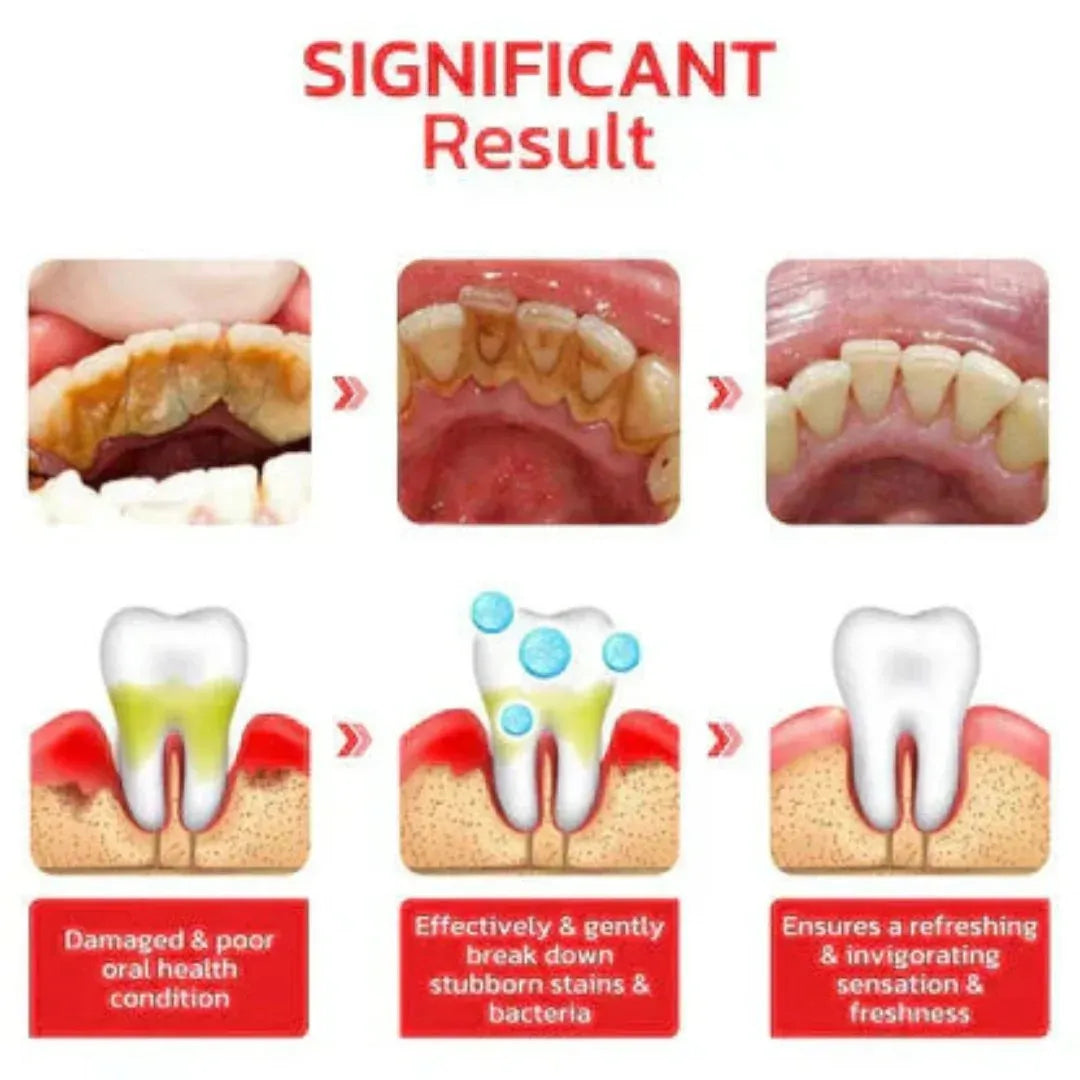 Sp-4 probiotic whitening toothpaste, Teeth Whitener Toothpaste, Natural Tooth Whitener (Buy 1 Get 1 Free)
